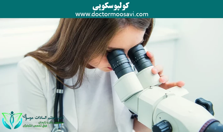 کولپوسکوپی